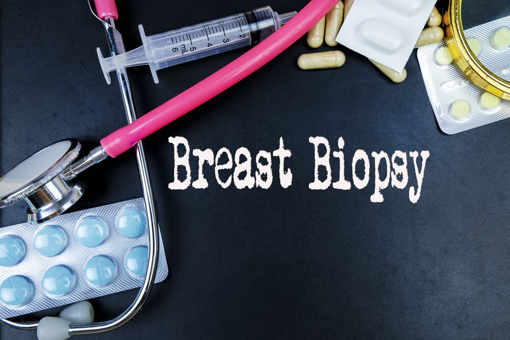 breast-biopsies-everything-you-need-to-know-my-druggenius